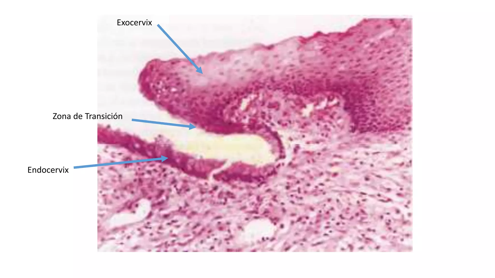 Características Citológicas del Epitelio Cervical Normal.pptx
