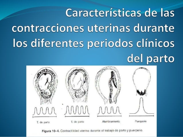 Características de las contracciones uterinas