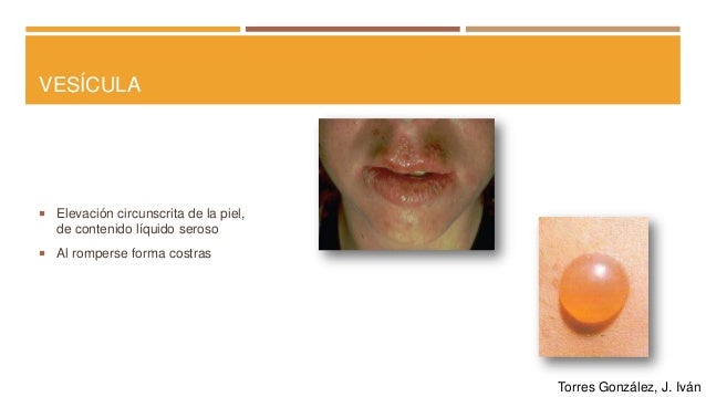 Características de las lesiones de la piel