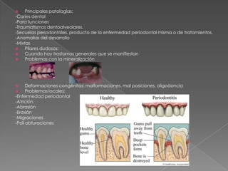     Principales patologías:
-Caries dental
-Para funciones
-Traumatismos dentoalveolares.
-Secuelas periodontales, producto de la enfermedad periodontal misma o de tratamientos.
-Anomalias del desarrollo
-Mixtas
    Pilares dudosos:
    Cuando hay trastornos generales que se manifiestan
    Problemas con la mineralización




     Deformaciones congénitas: malformaciones, mal posiciones, oligodoncia
     Problemas locales:
-Enfermedad periodontal
-Atrición
-Abrasión
-Erosión
-Migraciones
-Poli obturaciones
 