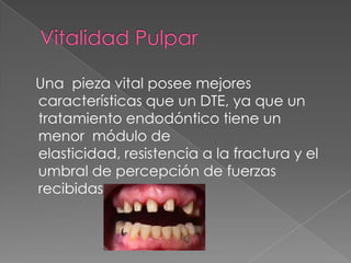 Una pieza vital posee mejores
características que un DTE, ya que un
tratamiento endodóntico tiene un
menor módulo de
elasticidad, resistencia a la fractura y el
umbral de percepción de fuerzas
recibidas.
 
