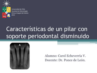 Universidad de Chile
 Facultad de Odontología
 Clínica Integral del Adulto
 2012




Características de un pilar con
soporte periodontal disminuido


                               Alumno: Carol Echeverría V.
                               Docente: Dr. Ponce de León.
 