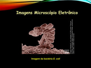 Imagens Microscópio Eletrônico
Imagem da bactéria E. coli
Imagem:
Bactéria
E.
coli,
ampliada
10.000
vezes
/
Foto
por
Eric
Erbe,
colorização
digital,
Christopher
Pooley,
amboms
do
USDA,
ARS,
a
UEM
/
Public
Domain.
 