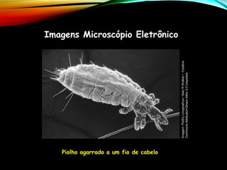 Piolho agarrado a um fio de cabelo
Imagens Microscópio Eletrônico
Imagem:
Piolho
Linognathus
/
Alan
R
Walker
/
Creative
Commons
Attribution-Share
Alike
3.0
Unported.
 