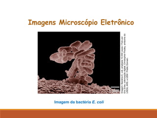 Imagens Microscópio Eletrônico
Imagem da bactéria E. coli
Imagem:
Bactéria
E.
coli,
ampliada
10.000
vezes
/
Foto
por
Eric
Erbe,
colorização
digital,
Christopher
Pooley,
amboms
do
USDA,
ARS,
a
UEM
/
Public
Domain.
 