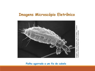 Piolho agarrado a um fio de cabelo
Imagens Microscópio Eletrônico
Imagem:
Piolho
Linognathus
/
Alan
R
Walker
/
Creative
Commons
Attribution-Share
Alike
3.0
Unported.
 