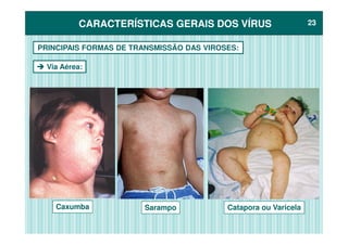 CARACTERÍSTICAS GERAIS DOS VÍRUSCARACTERÍSTICAS GERAIS DOS VÍRUS 2323
PRINCIPAIS FORMAS DE TRANSMISSÃO DAS VIROSES:
Via Aérea:
Caxumba Sarampo Catapora ou Varicela
 