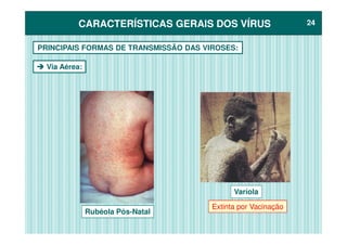 CARACTERÍSTICAS GERAIS DOS VÍRUSCARACTERÍSTICAS GERAIS DOS VÍRUS 2424
PRINCIPAIS FORMAS DE TRANSMISSÃO DAS VIROSES:
Via Aérea:
Rubéola Pós-Natal
Varíola
Extinta por Vacinação
 