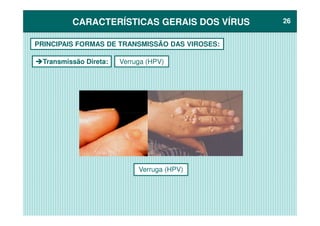 CARACTERÍSTICAS GERAIS DOS VÍRUSCARACTERÍSTICAS GERAIS DOS VÍRUS 2626
Transmissão Direta:
PRINCIPAIS FORMAS DE TRANSMISSÃO DAS VIROSES:
Verruga (HPV)
Verruga (HPV)
 