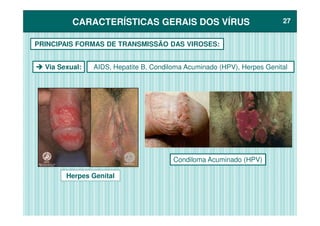 CARACTERÍSTICAS GERAIS DOS VÍRUSCARACTERÍSTICAS GERAIS DOS VÍRUS 2727
PRINCIPAIS FORMAS DE TRANSMISSÃO DAS VIROSES:
AIDS, Hepatite B, Condiloma Acuminado (HPV), Herpes GenitalVia Sexual:
Herpes Genital
Condiloma Acuminado (HPV)
 