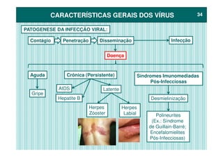CARACTERÍSTICAS GERAIS DOS VÍRUSCARACTERÍSTICAS GERAIS DOS VÍRUS 3434
PATOGENESE DA INFECÇÃO VIRAL:
Contágio Penetração Disseminação Infecção
Doença
Síndromes ImunomediadasAguda Crônica (Persistente) Síndromes Imunomediadas
Pós-Infecciosas
Desmielinização
Polineurites
(Ex.: Síndrome
de Guillain-Barré;
Encefalomielites
Pós-Infecciosas)
Gripe
AIDS
Hepatite B
Latente
Herpes
Zóoster
Herpes
Labial
 