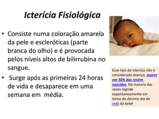 Icterícia Fisiológica
• Consiste numa coloração amarela
da pele e escleróticas (parte
branca do olho) e é provocada
pelos níveis altos de bilirrubina no
sangue.
• Surge após as primeiras 24 horas
de vida e desaparece em uma
semana em média.
Esse tipo de icterícia não é
considerado doença, ocorre
em 50% dos recém-
nascidos. Na maioria das
vezes regride
espontaneamente em
torno do décimo dia de
vida do bebê
 
