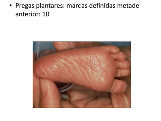 • Pregas plantares: marcas definidas metade
anterior: 10
 