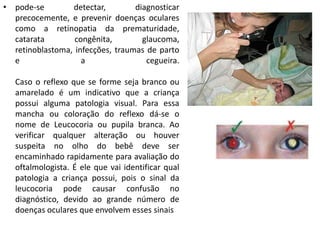 • pode-se detectar, diagnosticar
precocemente, e prevenir doenças oculares
como a retinopatia da prematuridade,
catarata congênita, glaucoma,
retinoblastoma, infecções, traumas de parto
e a cegueira.
Caso o reflexo que se forme seja branco ou
amarelado é um indicativo que a criança
possui alguma patologia visual. Para essa
mancha ou coloração do reflexo dá-se o
nome de Leucocoria ou pupila branca. Ao
verificar qualquer alteração ou houver
suspeita no olho do bebê deve ser
encaminhado rapidamente para avaliação do
oftalmologista. É ele que vai identificar qual
patologia a criança possui, pois o sinal da
leucocoria pode causar confusão no
diagnóstico, devido ao grande número de
doenças oculares que envolvem esses sinais
 