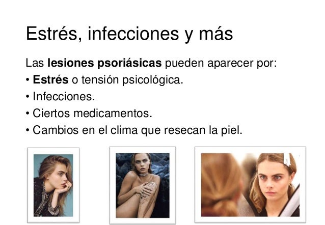 Las agudizaciones frecuentes de la psoriasis