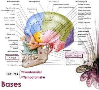 Escotadura sigmoideaA. malarFrontomalar