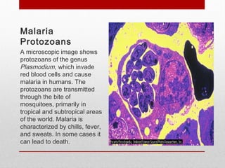 Malaria
Protozoans
A microscopic image shows
protozoans of the genus
Plasmodium, which invade
red blood cells and cause
malaria in humans. The
protozoans are transmitted
through the bite of
mosquitoes, primarily in
tropical and subtropical areas
of the world. Malaria is
characterized by chills, fever,
and sweats. In some cases it
can lead to death.
 