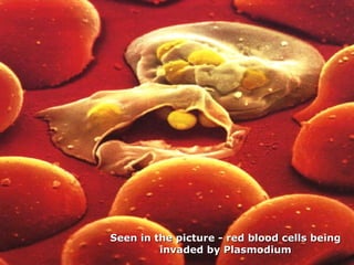 Seen in the picture - red blood cells beingSeen in the picture - red blood cells being
invaded by Plasmodiuminvaded by Plasmodium
 