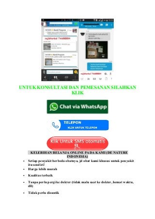 UNTUK KONSULTASI DAN PEMESANAN SILAHKAN
KLIK
KELEBIHAN BELANJA ONLINE PADA KAMI (DE NATURE
INDONESIA)
• Setiap penyakit berbeda obatnya, jd obat kami khusus untuk penyakit
itu sendiri!
• Harga lebih murah
• Kualitas terbaik
• Tanpa perlu pergi ke dokter (tidak malu saat ke dokter, hemat waktu,
dll)
• Tidak perlu disuntik
 