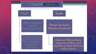 Median Nerve Injury and Carpal Tunnel Syndrome 