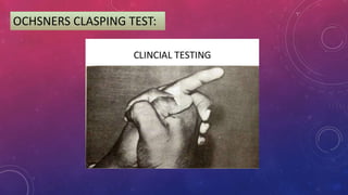 OCHSNERS CLASPING TEST:
 