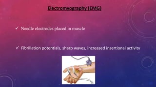 Electromyography (EMG)
 Needle electrodes placed in muscle
 Fibrillation potentials, sharp waves, increased insertional activity
 