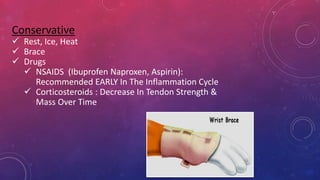 Conservative
 Rest, Ice, Heat
 Brace
 Drugs
 NSAIDS (Ibuprofen Naproxen, Aspirin):
Recommended EARLY In The Inflammation Cycle
 Corticosteroids : Decrease In Tendon Strength &
Mass Over Time
 