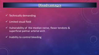 Disadvantages
 Technically demanding
 Limited visual field
 Vulnerability of the median nerve, flexor tendons &
superficial palmar arterial arch
 Inability to control bleeding
 