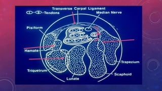 Median Nerve Injury and Carpal Tunnel Syndrome 