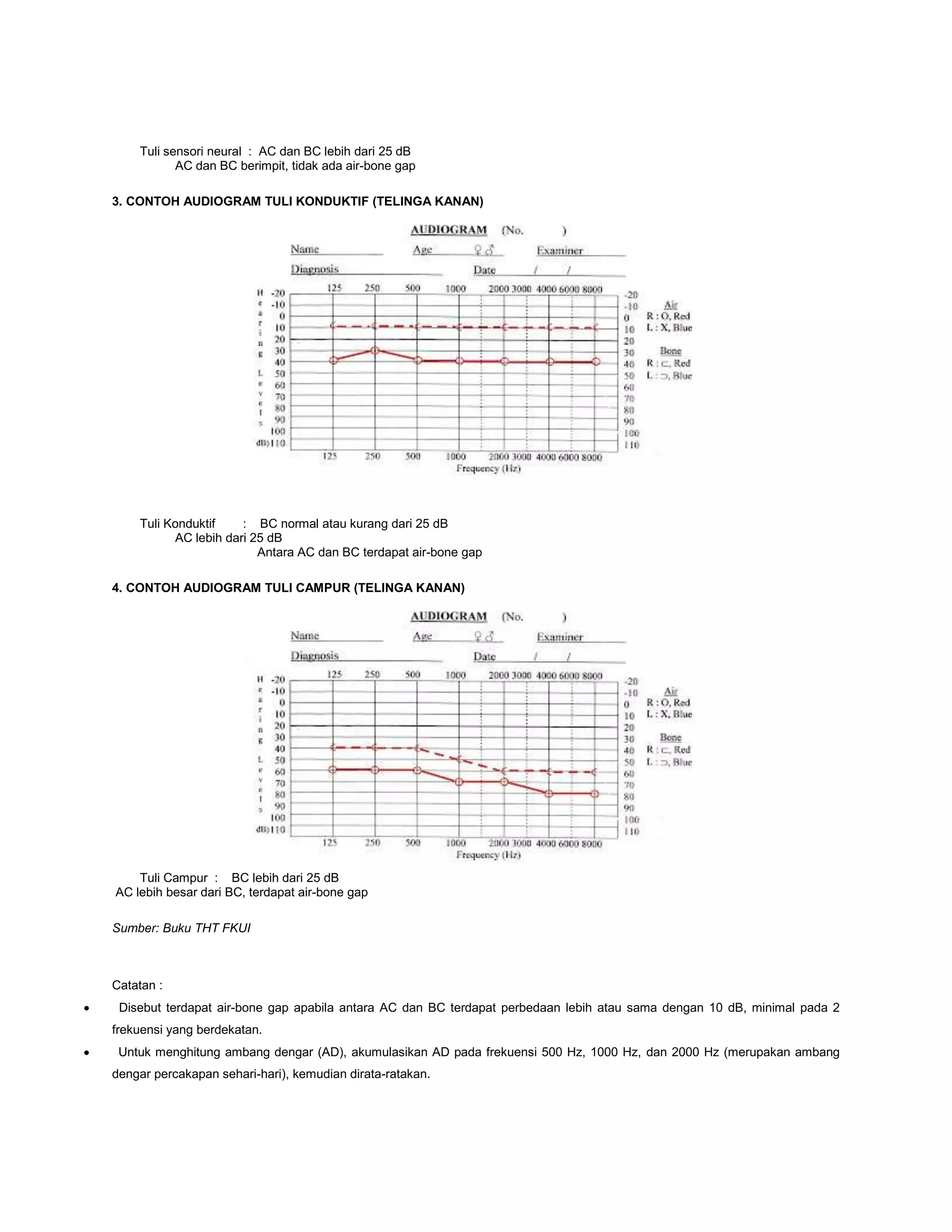 Cara pembacaan audiometri | DOCX