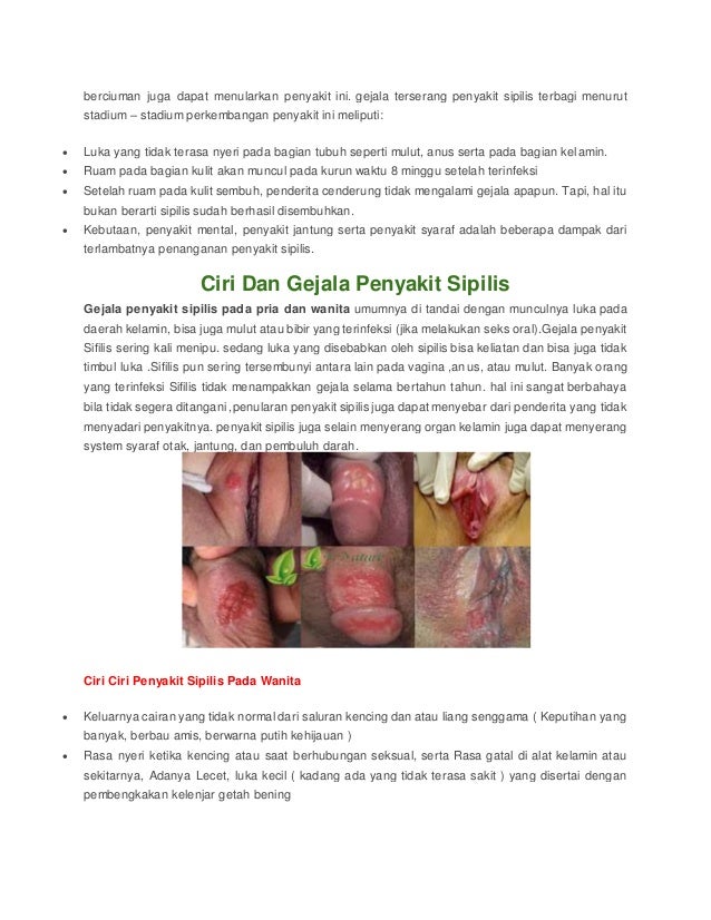 Cara penyembuhan penyakit sipilis pada wanita Cara penyembuhan penyakit sipilis pada wanita
