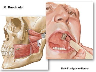 M. Buccinador




                Rafe Pterigomandibular
 