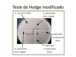 Teste de Hodge modificado
 