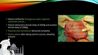 • Patient shifted for Emergency Lower segment
caesarean section .
• Patient delivered a female baby of 2020g and another
female baby of 2000g.
• Placenta and membranes delivered completly.
• Uterus atonic after taking uterine sutures, bleeding
present.
 