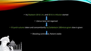 • Inj Oxytocin 10 IU i.m. and 40 IU iv infusion started
• Uterus tone not regained
• B Lynch sutures taken and concomitantly Inj Carbetocin 100micro gram slow iv given
• Bleeding controlled, Patient stable
 