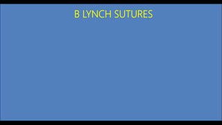 B LYNCH SUTURES
 