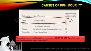 CAUSES OF PPH: FOUR “T”
Medicine (Baltimore). 2019 Nov; 98(47): e17911, Am Fam Physician. 2017 Apr 1;95(7):442-449
The most common cause of postpartum hemorrhage is uterine atony, which results from
poor contraction of the uterus after childbirth
 
