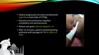 • Patient progressed normally and delivered
vaginally a male baby of 2750g.
• Placenta and membranes expelled
completely and spontaneously.
• Patient was given 10units oxytocin i.m.
• After 15 minutes, patient started bleeding
profusely with passage of 200 to 300cc of
clots
 