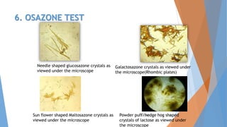 6. OSAZONE TEST
4/3/2016 28
Needle shaped glucosazone crystals as
viewed under the microscope
Galactosazone crystals as viewed under
the microscope(Rhombic plates)
Sun flower shaped Maltosazone crystals as
viewed under the microscope
Powder puff/hedge hog shaped
crystals of lactose as viewed under
the microscope
 