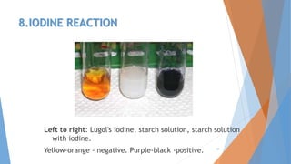 8.IODINE REACTION
Left to right: Lugol's iodine, starch solution, starch solution
with iodine.
Yellow-orange - negative. Purple-black -positive.4/3/2016 34
 