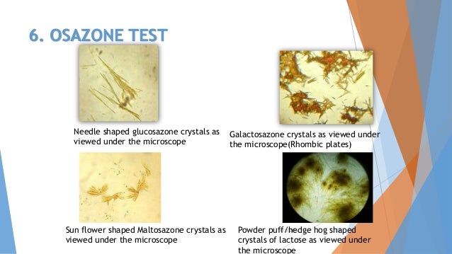 fructose osazone structure Carbohydrate fructose osazone structure Carbohydrate