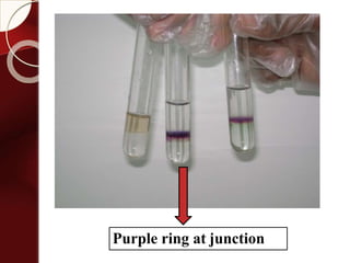 Purple ring at junction
 