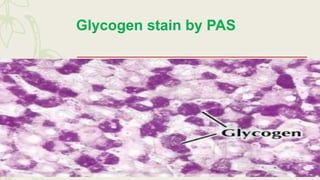 Glycogen stain by PAS
 