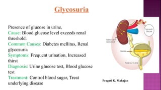 Glycosuria
Presence of glucose in urine.
Cause: Blood glucose level exceeds renal
threshold.
Common Causes: Diabetes mellitus, Renal
glycosuria
Symptoms: Frequent urination, Increased
thirst
Diagnosis: Urine glucose test, Blood glucose
test
Treatment: Control blood sugar, Treat
underlying disease
Pragati K. Mahajan
 