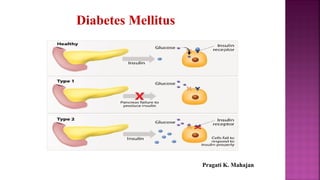 Diabetes Mellitus
Pragati K. Mahajan
 
