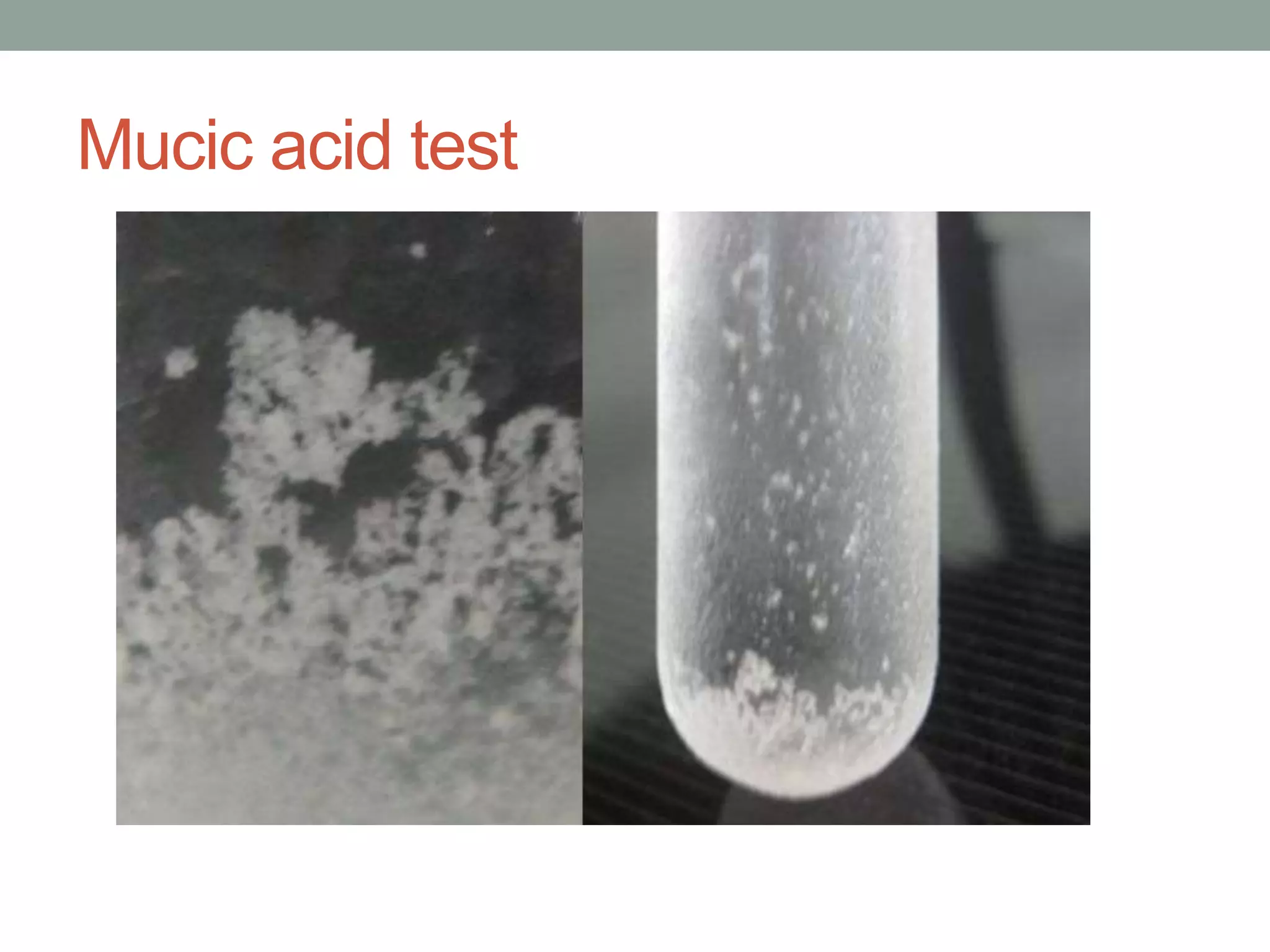 Mucic acid test
 
