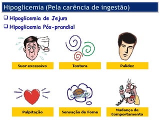  Hipoglicemia de Jejum
 Hipoglicemia Pós-prandial
 