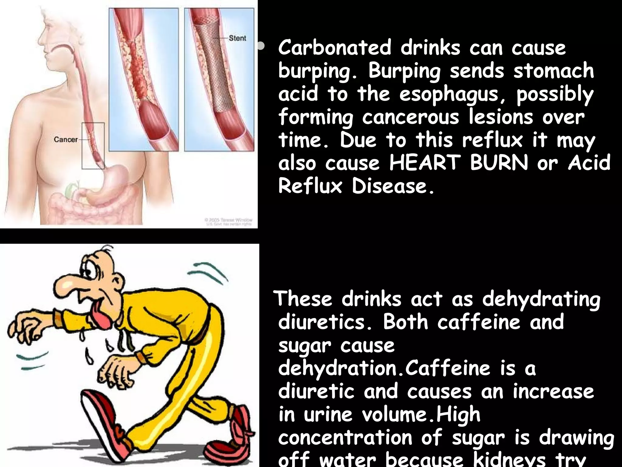 Does Carbonated Drinks Neutralize Stomach Acid
