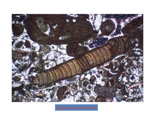 Bioclastic grainstone
 