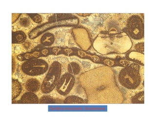 Oolithic-bioclastic Grainstone
 